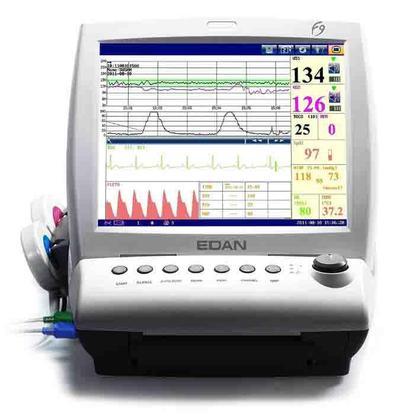 MONITOR FETAL Y MATERNO, MONITOR FETAL F9 EXPRESS